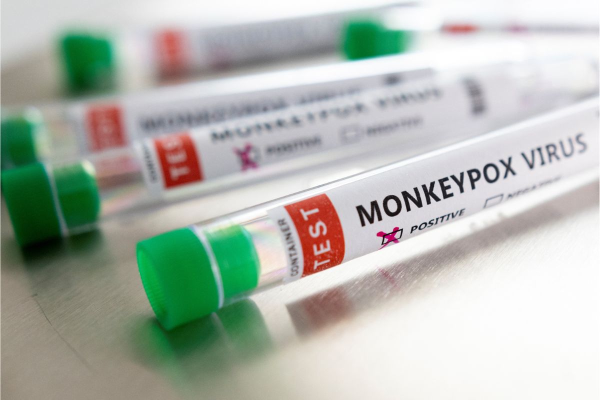 Advisory For International Passengers On Monkeypox